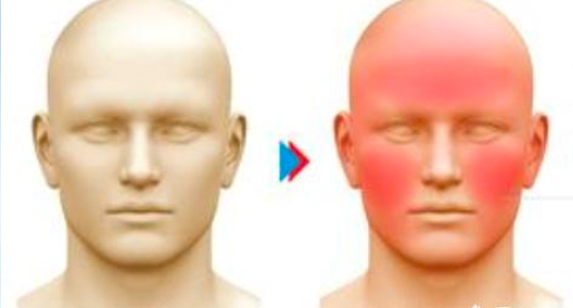 頭暈臉紅是常見的副作用